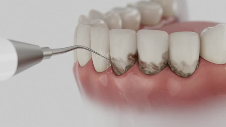 Trusted Teeth Cleaning And Checkup service in Jermyn, PA - Dentist Open Now